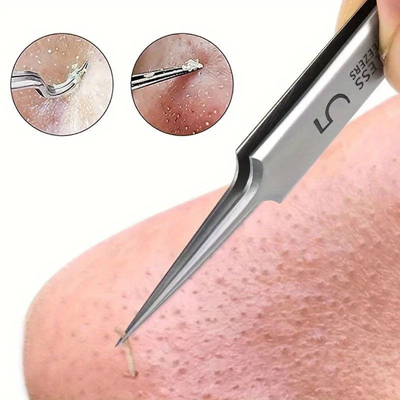 Blackhead and Acne Needle Remover